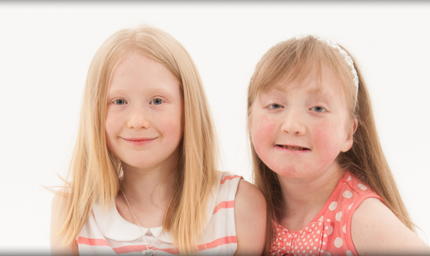 Kabuki Syndrome - Megan's Story